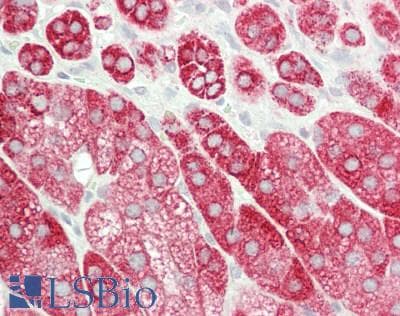 IHC-plus™ Polyclonal Rabbit anti-Human STRN4 Antibody (aa124-153, IHC, WB)