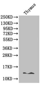 IHC-plus™ B2M / Beta 2 Microglobulin Antibody (aa 22-119)