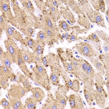 Polyclonal Rabbit anti-Human HSD17B13 Antibody (IHC, WB)