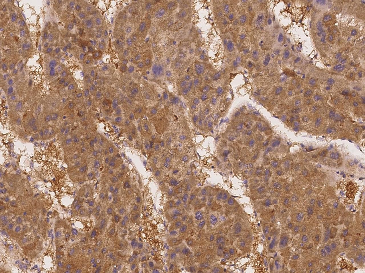 SLC44A1 / CD92 Antibody