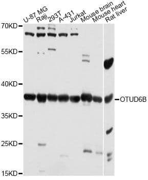 Polyclonal Rabbit anti-Human OTUD6B Antibody (WB)