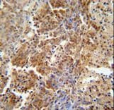 CSA / ERCC8 Antibody (aa210-238)