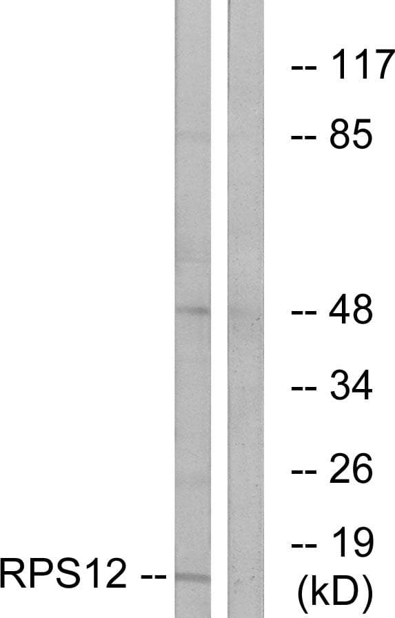Polyclonal Rabbit anti-Human RPS12 / Ribosomal Protein S12 Antibody (IF, WB)