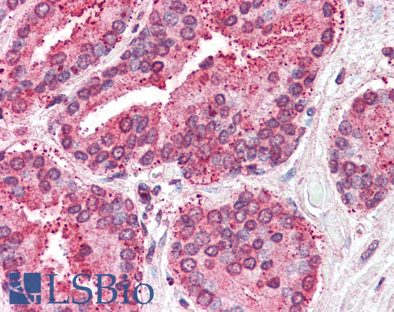 IHC-plus™ Polyclonal Rabbit anti-Human TM4SF6 / TSPAN6 Antibody (Internal, IHC)