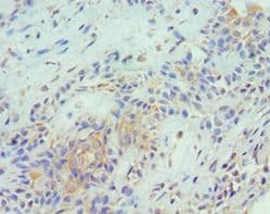Polyclonal Rabbit anti-Human TNFSF13 / APRIL Antibody (aa105-247, IHC)
