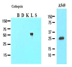 IHC-plus™ Monoclonal Mouse anti-Human CTSL / Cathepsin L Antibody (clone 2H7, aa114-333, IHC, WB)