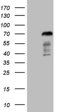 Monoclonal Mouse anti-Human FOXO4 / AFX1 Antibody (clone OTI8A8, Carrier-free, aa206-505, IHC, WB)