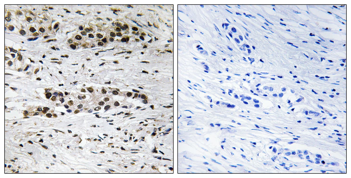Polyclonal Rabbit anti-Human ER Alpha / Estrogen Receptor Antibody (phospho-Ser102, IHC)
