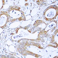 CML / BCR Antibody (N-Terminus)