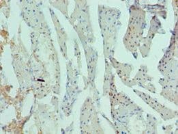 RAD51L3 / RAD51D Antibody (aa1-328)