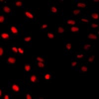 Polyclonal Rabbit anti-Human DHAND / HAND2 Antibody (IF, WB)