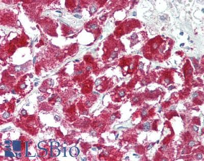 MER / MERTK Antibody (aa587-858)