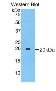 SERPINA1 / Alpha 1 Antitrypsin Antibody (aa27-181)