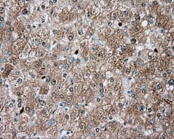 TPMT Antibody (clone OTI4C1)