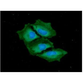 TRAIL-R3 / DCR1 Antibody (clone AT1E12)