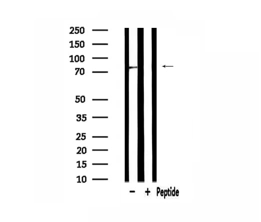 Polyclonal Rabbit anti-Human GUSB / Beta Glucuronidase Antibody (IF, WB)