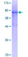 Human HEXA Protein (Recombinant GST)