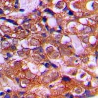 Polyclonal Rabbit anti-Human RPS12 / Ribosomal Protein S12 Antibody (C-Terminus, IHC, IF, WB)
