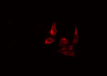 ARHGAP9 Antibody