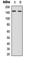 c-Met Antibody (Internal)