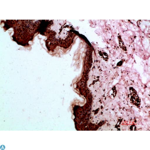 DSG1 / Desmoglein 1 Antibody