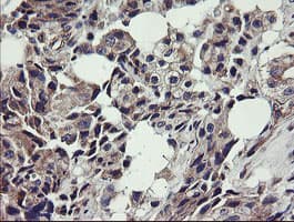 UBE2J1 Antibody (clone OTI3E6)