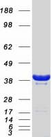 Human GIPC1 / GIPC Protein (Recombinant Myc-DDK (Flag))