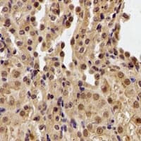 PHF21B Antibody