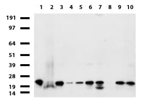 Monoclonal Mouse anti-Human NME1 / NM23 Antibody (clone UMAB92, IHC, IF, WB)