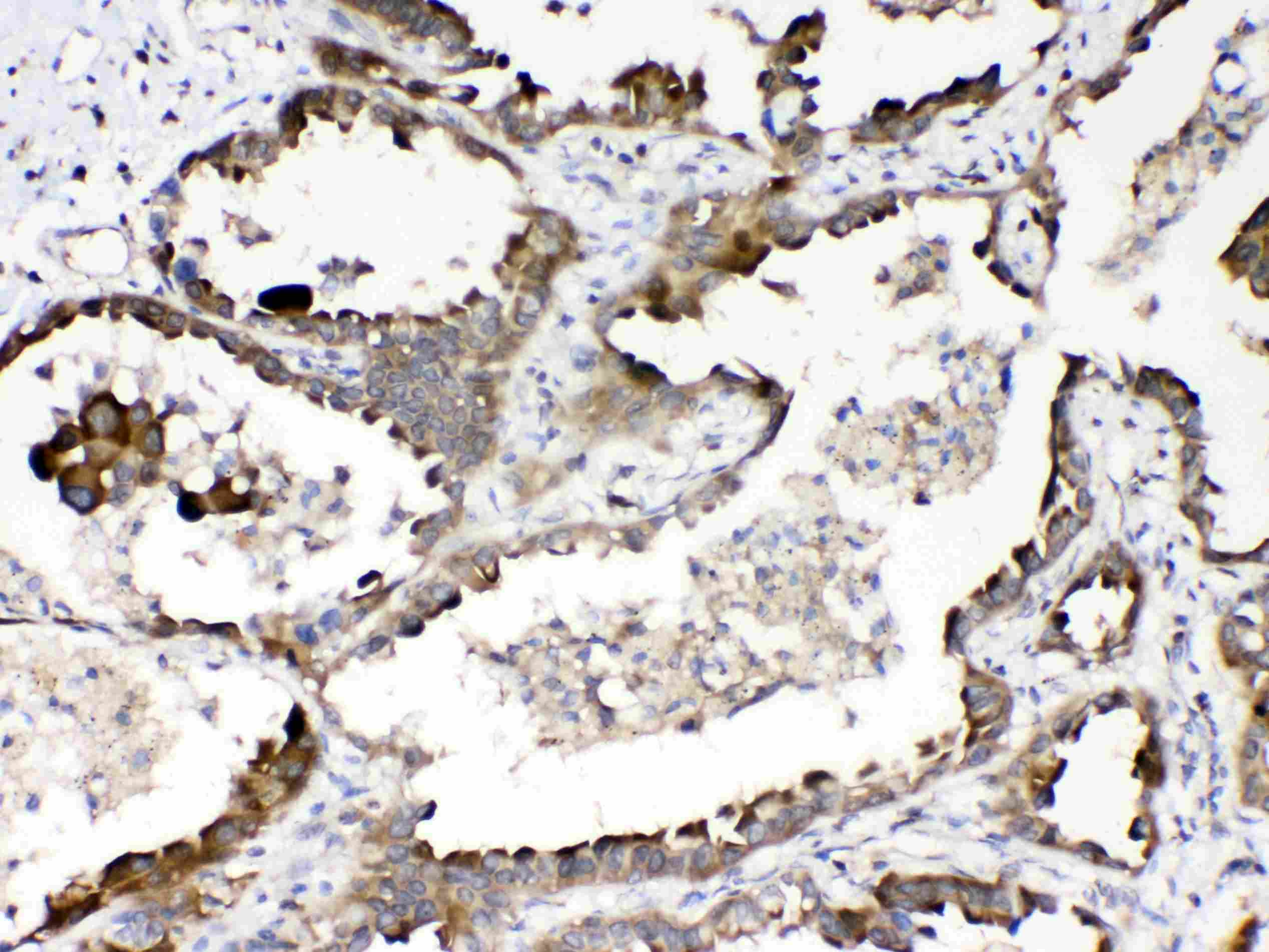 Polyclonal Rabbit anti-Human RANBP1 Antibody (IHC, WB)