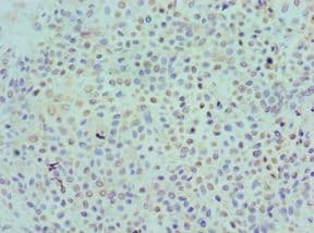 KIR2DS4 Antibody (aa22-245)