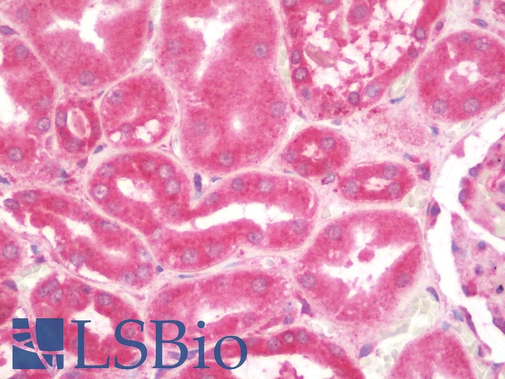 KANK1 Antibody