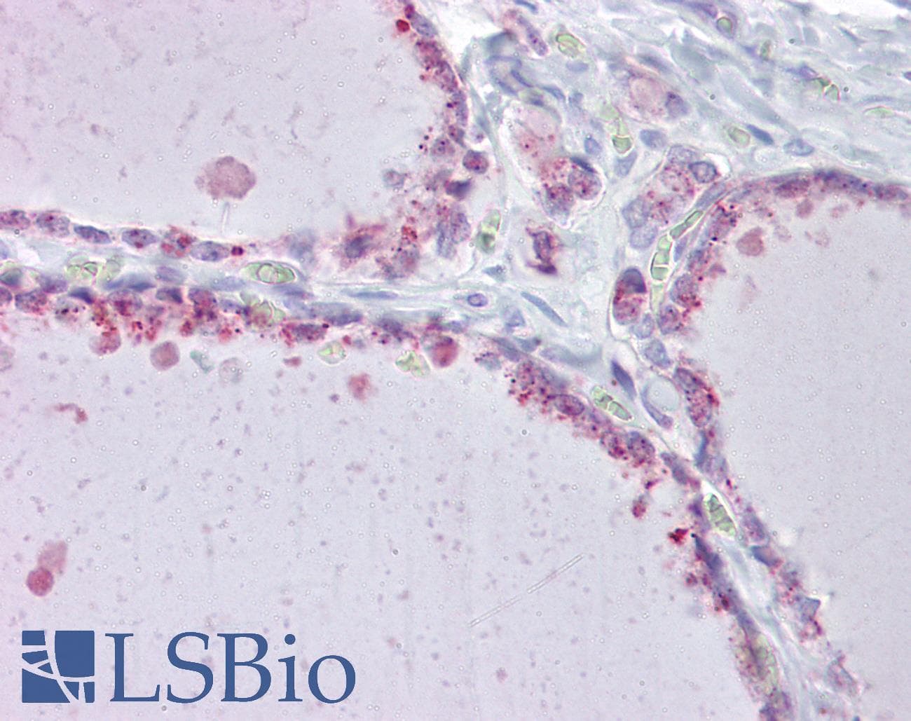 SLC26A4 / Pendrin Antibody (aa287-336, HRP)