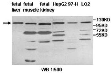 Polyclonal Rabbit anti-Human IMPG1 Antibody (aa217-437, IHC, WB)