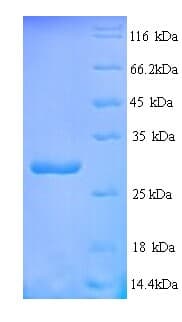 Drimia maritima Ribosome-inactivating Protein Charybdin (Recombinant His)