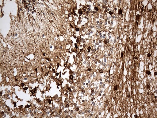 S100B / S100 Beta Antibody (clone OTI3G6)
