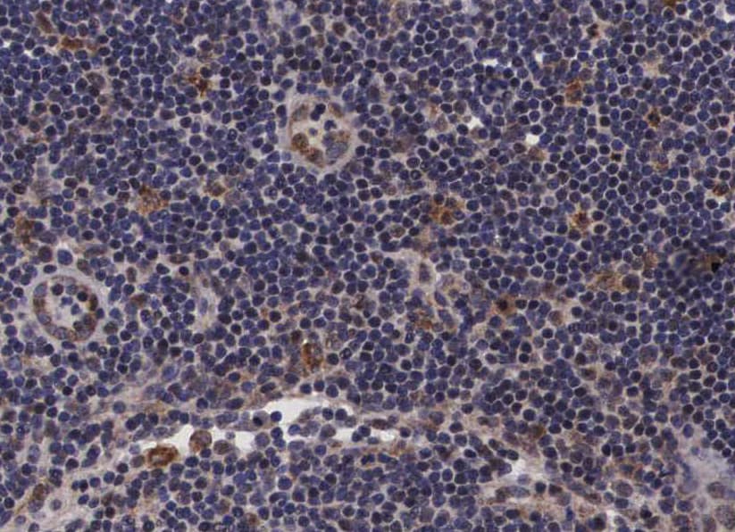 PDZD2 Antibody