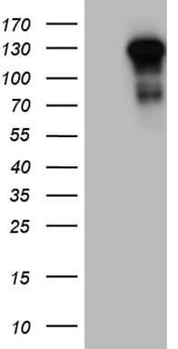 Monoclonal Mouse anti-Human TLR8 Antibody (clone OTI4F3, aa32-153, IHC, WB)