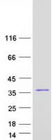 Human CA13 / Carbonic Anhydrase XIII Protein (Recombinant Myc-DDK (Flag))