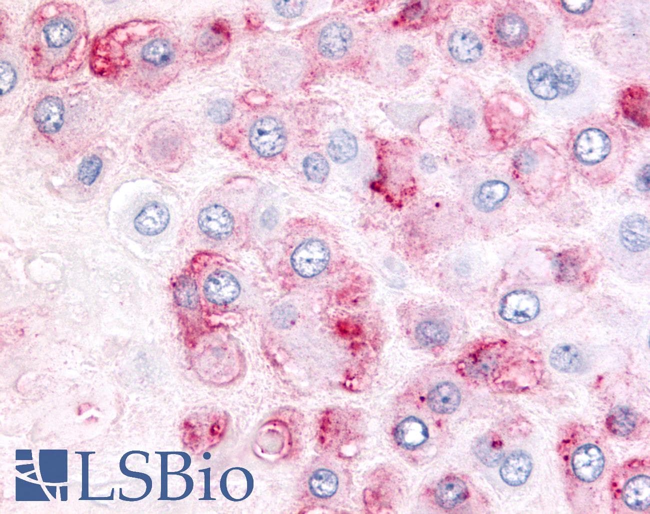 PathPlus™ ADAMTS5 Antibody (Metalloprotease Domain)
