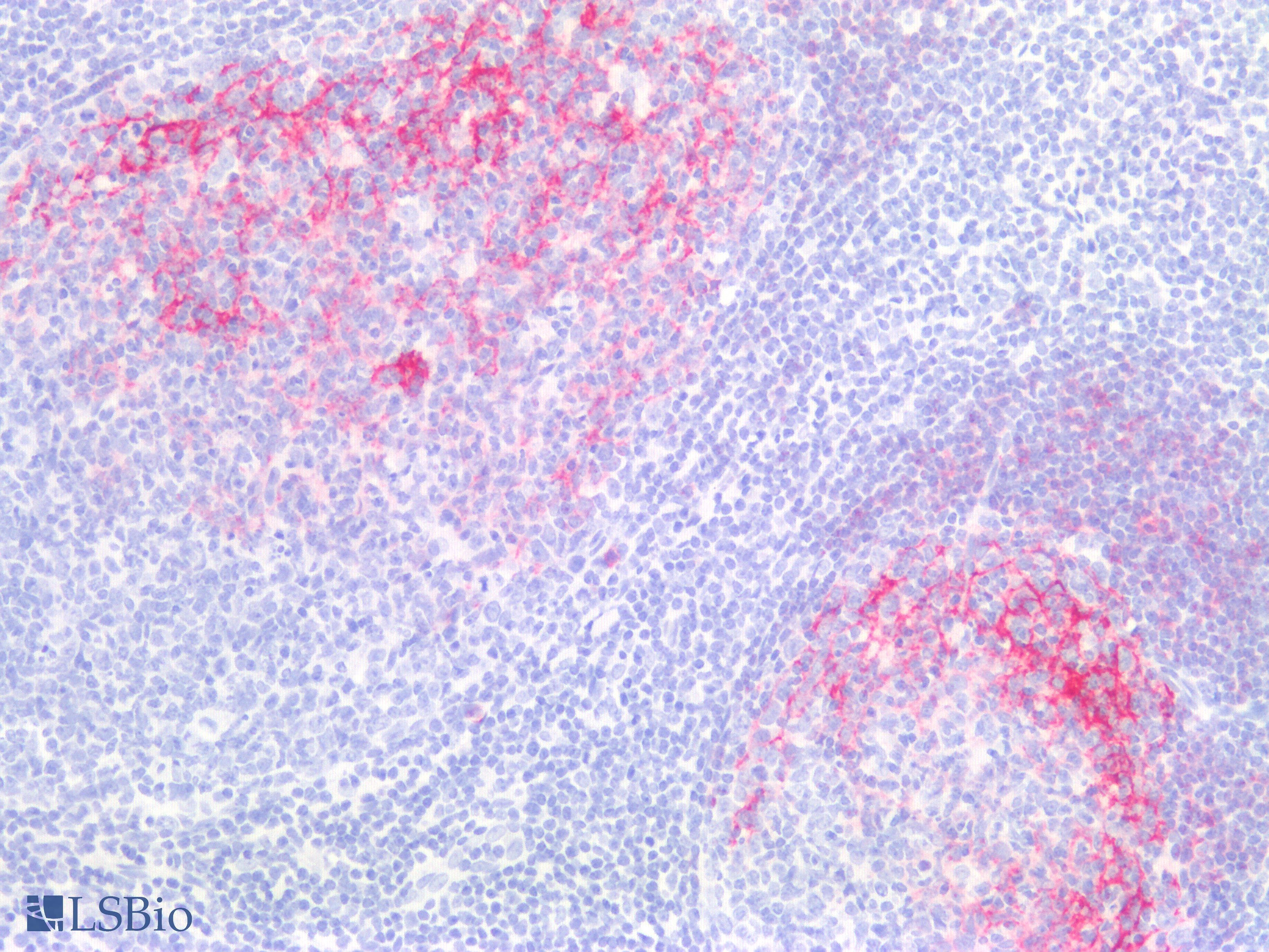 FCER2 / CD23 Antibody (clone 1B12)