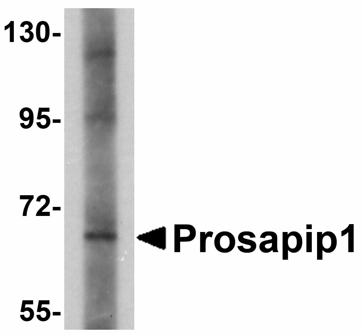 LZTS3 Antibody