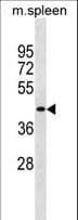 SLC10A2 / ASBT Antibody (aa39-65)