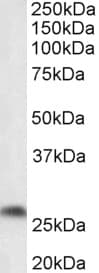 Prostaglandin D Synthase Antibody (aa149-162)