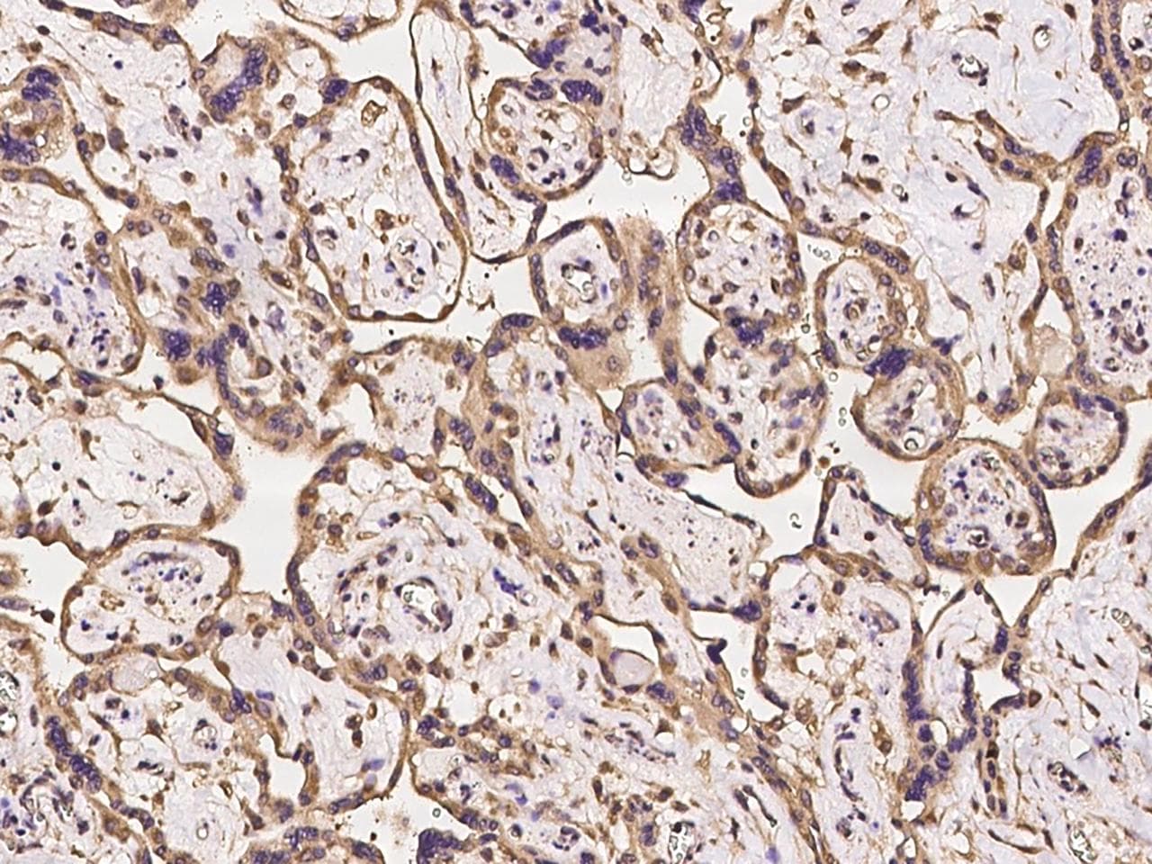 TMCC2 Antibody