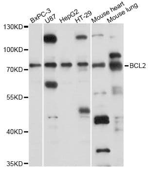 Polyclonal Rabbit anti-Human SLC37A2 Antibody (WB)