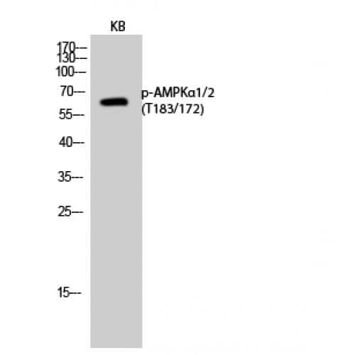 PRKAA1 + PRKAA2 Antibody (110-190 aa)