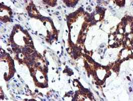 NDUFB9 Antibody (clone OTI13H11)