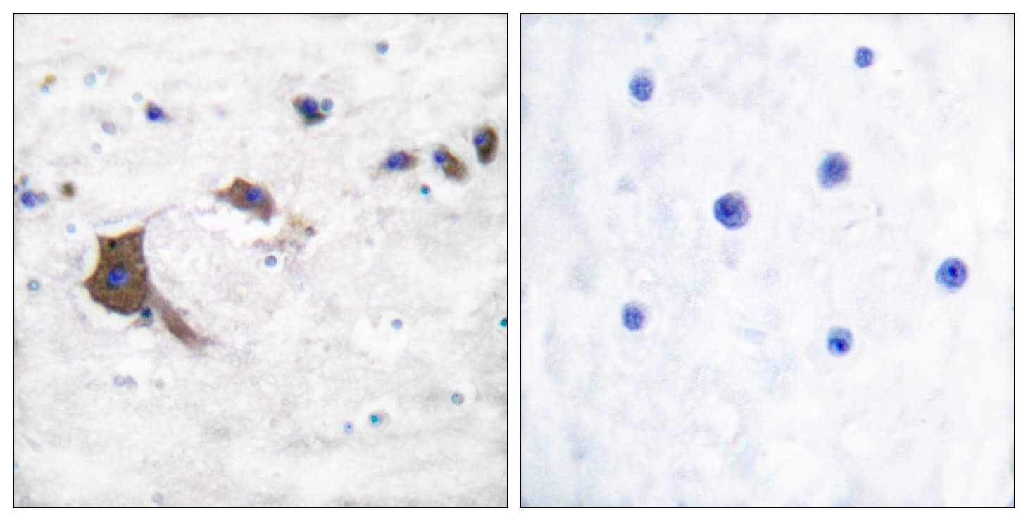 HSD17B10 / HADH2 Antibody (aa111-160)