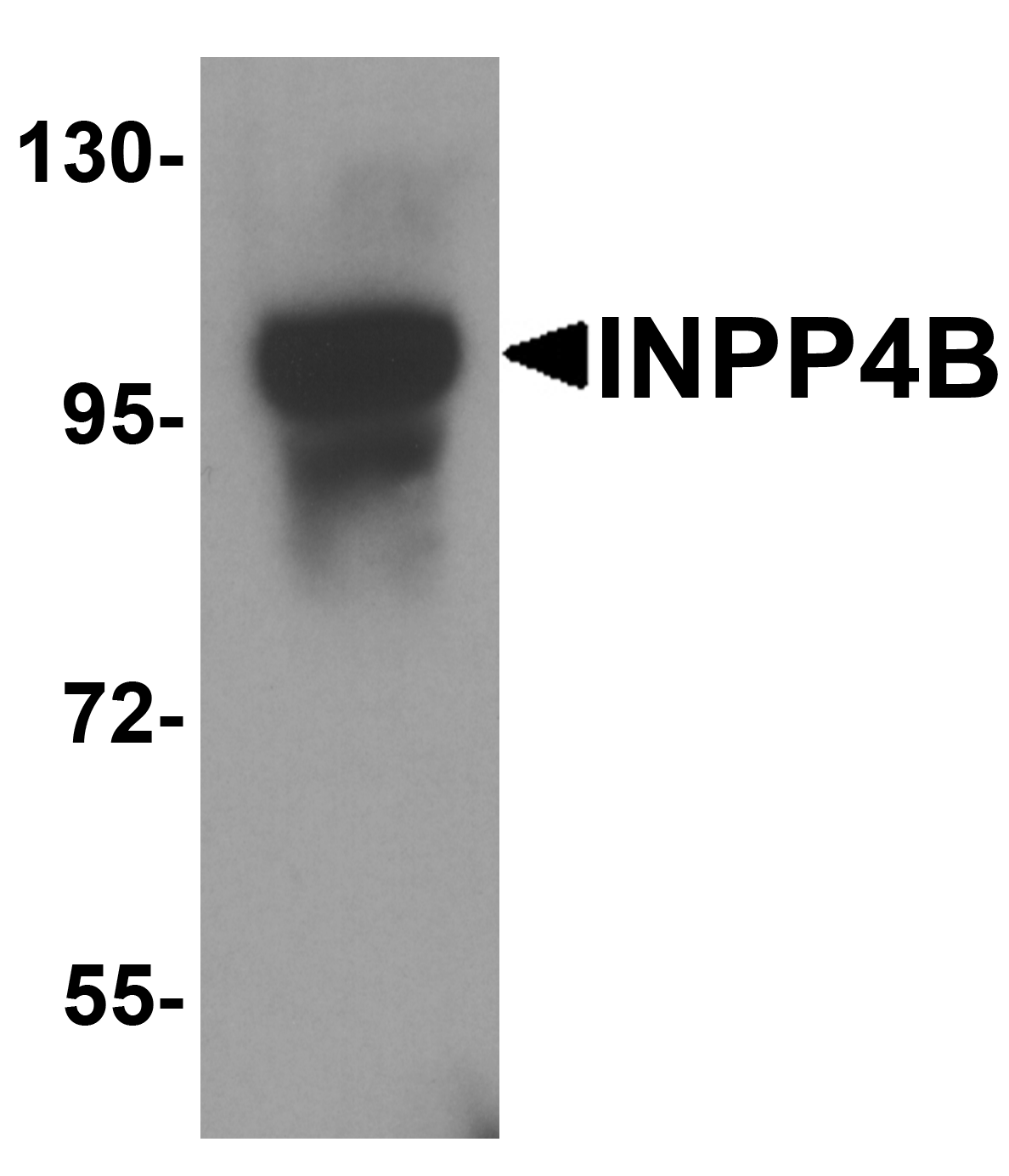 IHC-plus™ Polyclonal Rabbit anti-Human INPP4B Antibody (IHC, WB)